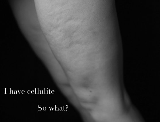 i-have-cellulite-so-what